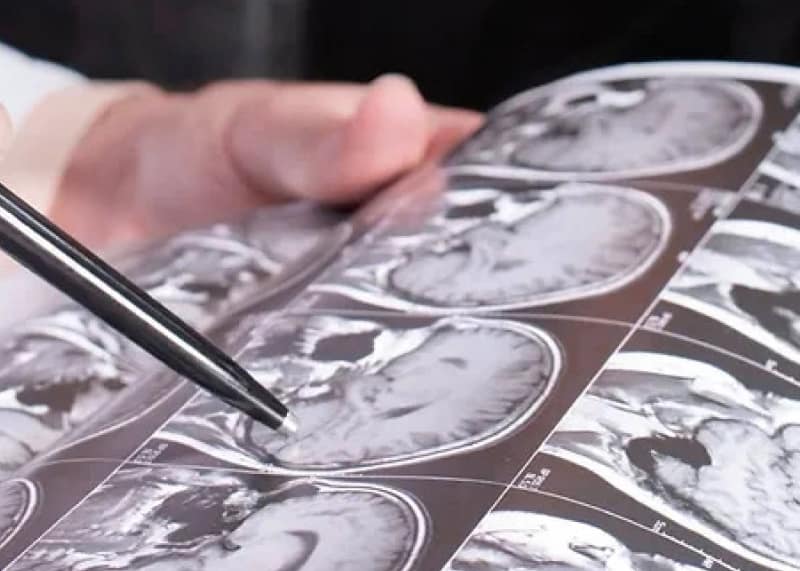 DICOMJet and imaging workflow at Crystal Radiology