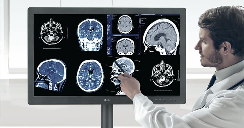Diagnostic imaging on LG medical displays