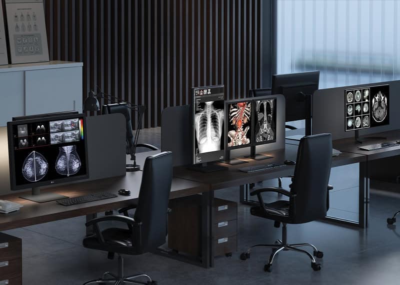 LG medical display range