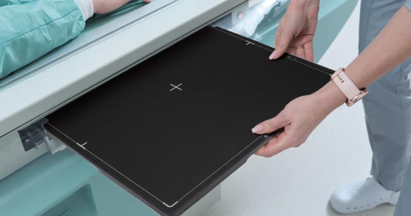 LG digital X-ray detector