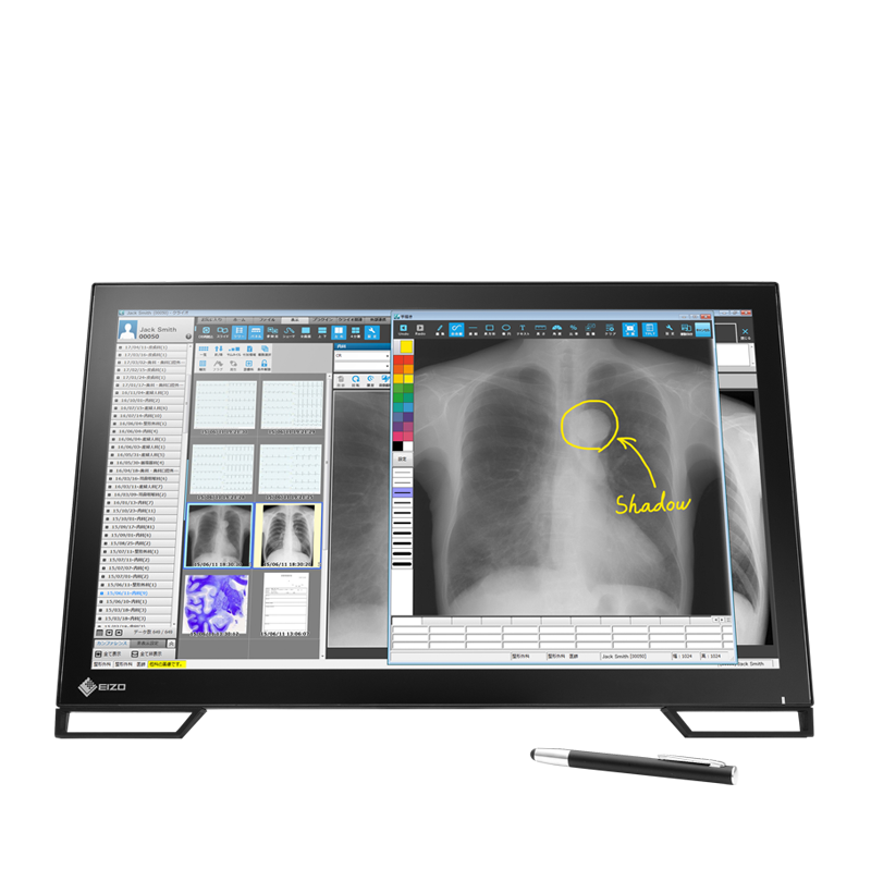 EIZO RadiForce MS236WT A, product photo
