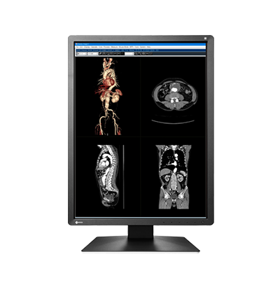 EIZO RadiForce MX216, product photo