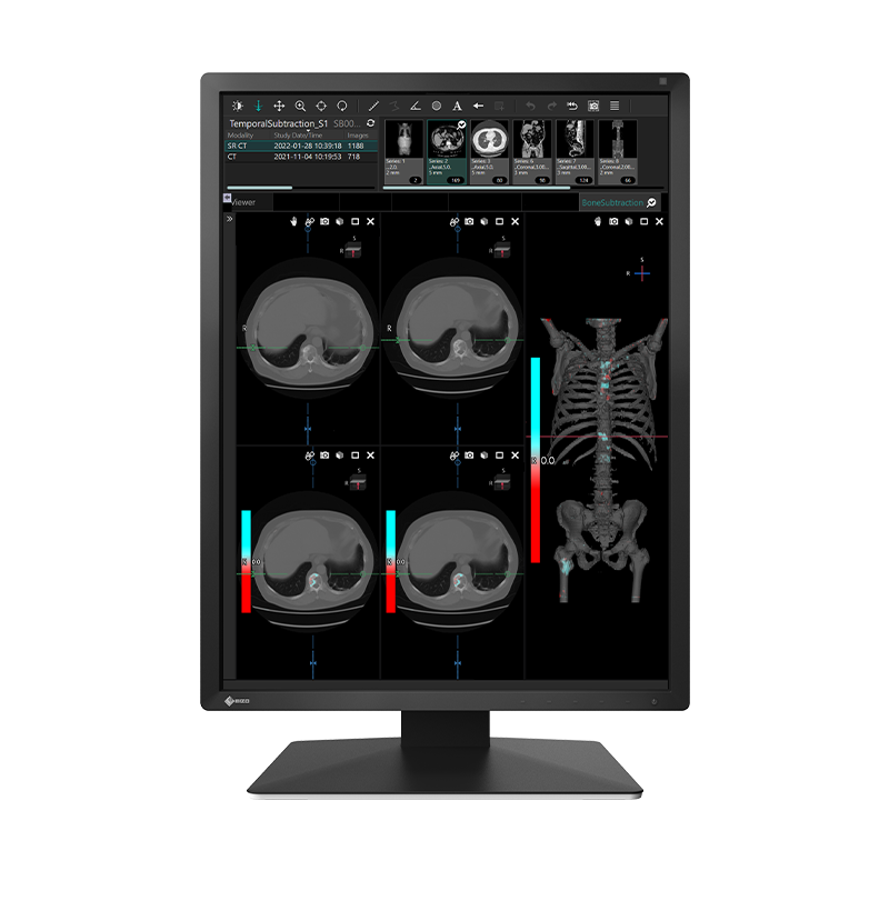 EIZO RadiForce MX217, product photo