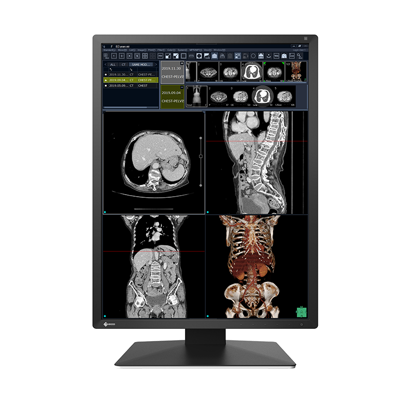 EIZO RadiForce RX270, product photo