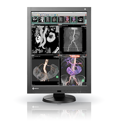 EIZO RadiForce RX340, product photo
