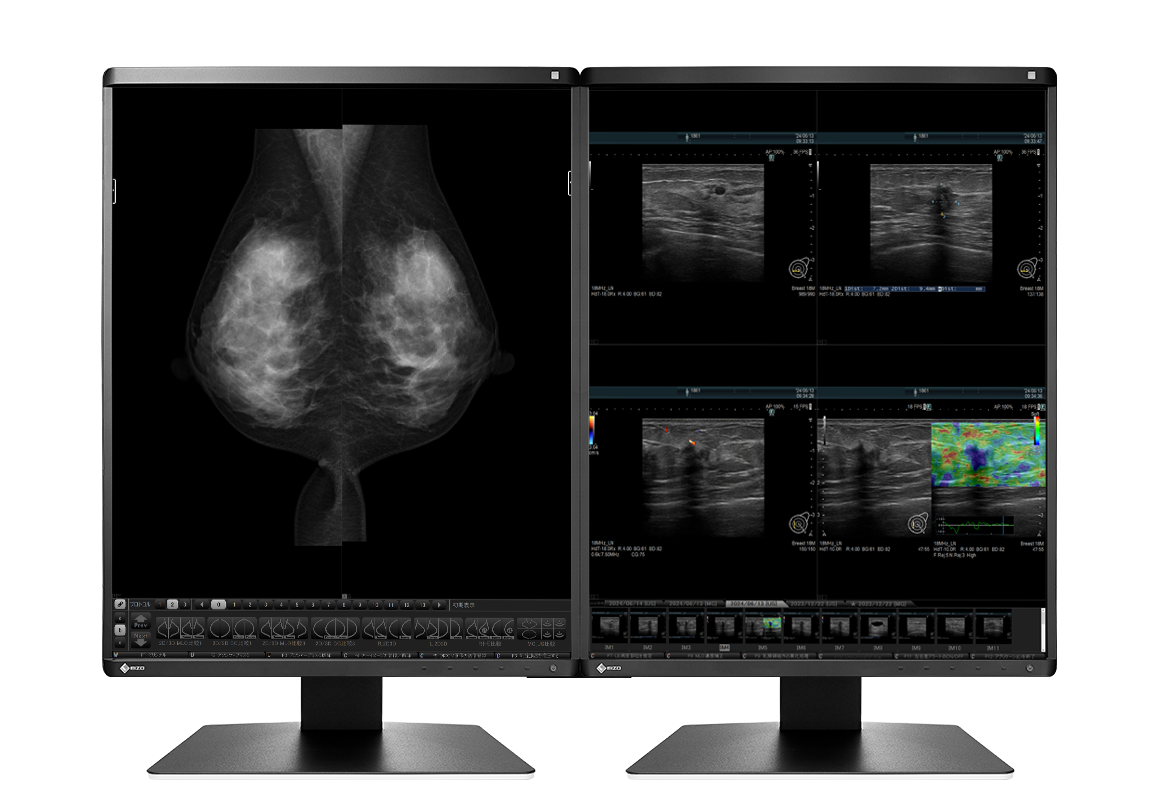 EIZO RadiForce RX570, product photo