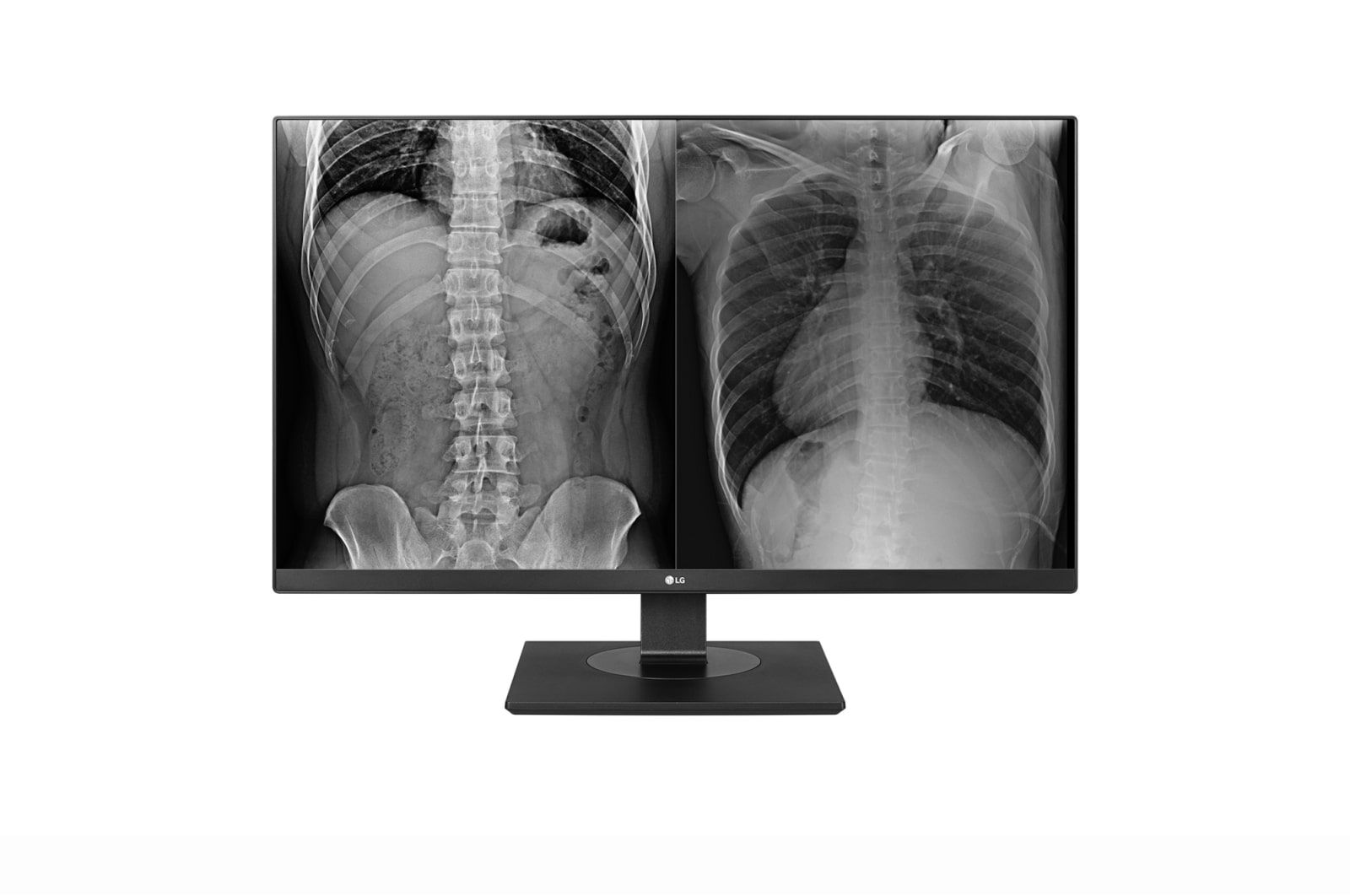 LG 27″ 8MP IPS clinical review monitor, front product view