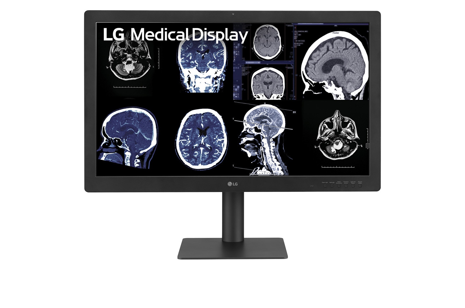 Monitor diagnóstico LG 32HQ713D B 31,5″ 8MP IPS Black, el modelo desplegado en Alfred Health como parte de su cambio a nivel empresa desde EIZO RadiForce hacia monitores diagnósticos LG